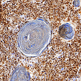 Helios was detected in immersion fixed paraffin-embedded sections of human thymus using Mouse Anti-Human Helios Monoclonal Antibody (Catalog # MAB73091) at 0.5 µg/mL for 1 hour at room temperature followed by incubation with the Anti-Mouse IgG VisUCyte™ HRP Polymer Antibody (Catalog # VC001). Tissue was stained using DAB (brown) and counterstained with hematoxylin (blue). Specific staining was localized to nuclei in cells around Hassall's corpuscles. View our protocol for IHC Staining with VisUCyte HRP Polymer Detection Reagents.