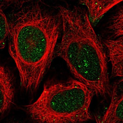 Immunocytochemistry/Immunofluorescence: BEND7 Antibody [NBP1-89913] - Immunofluorescent staining of human cell line U-2 OS shows localization to nucleus, nucleoli fibrillar center & vesicles.