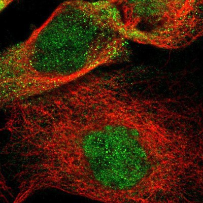 Immunocytochemistry/Immunofluorescence: ZNF367 Antibody [NBP1-81976] - Staining of human cell line A-431 shows positivity in nucleus but not nucleoli and cytoplasm.