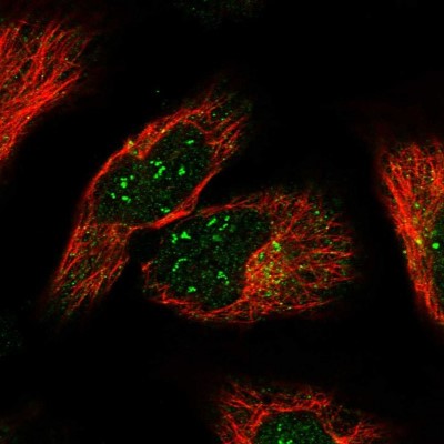 Immunocytochemistry/Immunofluorescence: KIAA0922 Antibody [NBP2-30898] - Immunofluorescent staining of human cell line U-2 OS shows localization to nucleoli fibrillar center & vesicles.
