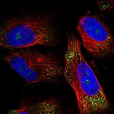 Immunocytochemistry/Immunofluorescence: OTUD7A Antibody [NBP1-88434] - Staining of human cell line U-251 MG shows positivity in nucleoli and cytoplasm.