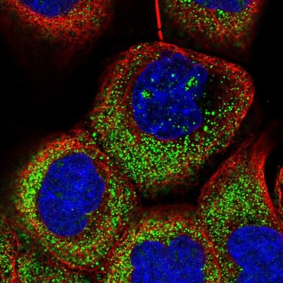 Immunocytochemistry/Immunofluorescence: OTUD7A Antibody [NBP1-88434] - Immunofluorescent staining of human cell line A-431 shows localization to nucleoli & cytosol.