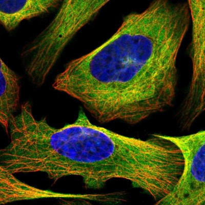 Immunocytochemistry/Immunofluorescence: MAP4 Antibody [NBP1-85874] - Immunofluorescent staining of human cell line U-2 OS shows localization to plasma membrane, cytosol & microtubules.