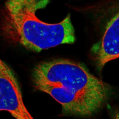 Immunocytochemistry/Immunofluorescence: LARP4 Antibody [NBP1-80889] - Immunofluorescent staining of human cell line U-2 OS shows localization to nucleoli fibrillar center & cytosol.