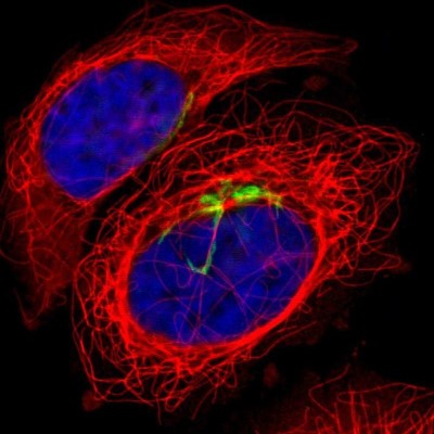 Immunocytochemistry/Immunofluorescence: Polypeptide GalNac Transferase 3/GALNT3 Antibody [NBP1-81849] - Immunofluorescent staining of human cell line A-431 shows localization to the Golgi apparatus.