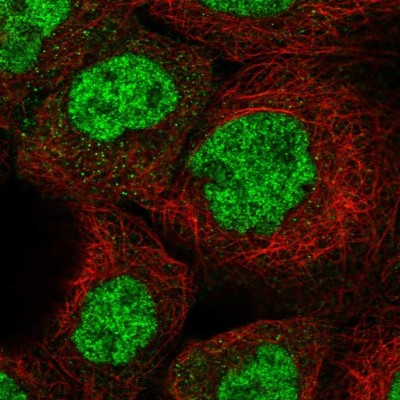 Immunocytochemistry/Immunofluorescence: HEXDC Antibody [NBP1-83573] - Staining of human cell line A-431 shows positivity in nucleus but not nucleoli.