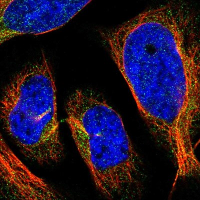 Immunocytochemistry/Immunofluorescence: HLCS Antibody [NBP1-81759] - Immunofluorescent staining of human cell line U-2 OS shows localization to cytosol.