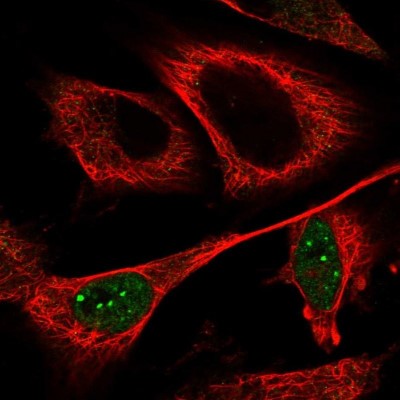 Immunocytochemistry/Immunofluorescence: CCDC102A Antibody [NBP1-82766] - Staining of human cell line U-251 MG shows positivity in nucleus but not nucleoli.