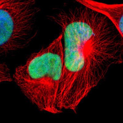 Immunocytochemistry/Immunofluorescence: FBXO18 Antibody [NBP1-83921] Staining of human cell line U-251MG shows positivity in nuclei.