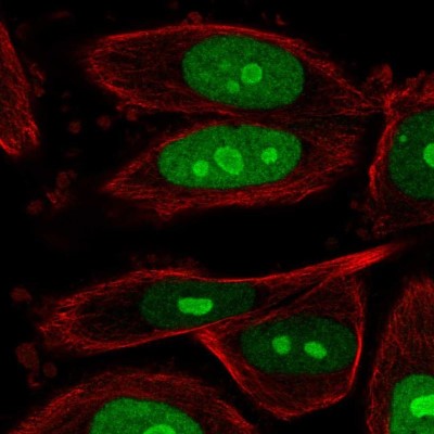 Immunocytochemistry/Immunofluorescence: BOP1 Antibody [NBP2-33504] - Immunofluorescent staining of human cell line PC-3 shows localization to nucleus & nucleoli.
