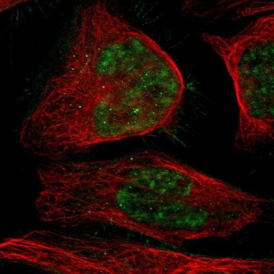 Immunocytochemistry/Immunofluorescence: C17orf85 Antibody [NBP2-30657] - Staining of human cell line U-2 OS shows positivity in nucleus but excluded from the nucleoli.