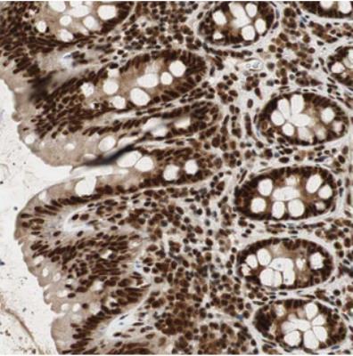 Immunohistochemistry: C17orf85 Antibody [NBP2-30657] - Staining of human colon shows strong nuclear positivity in glandular cells.