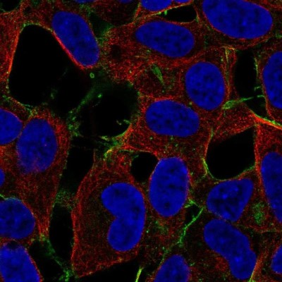 Immunocytochemistry/Immunofluorescence: STARD4 Antibody [NBP2-30538] - Staining of human cell line SH-SY5Y shows localization to plasma membrane.