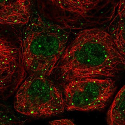 Immunocytochemistry/Immunofluorescence: EDC4 Antibody [NBP2-13944] - Staining of human cell line A-431 shows localization to nucleoplasm & cytoplasmic bodies.