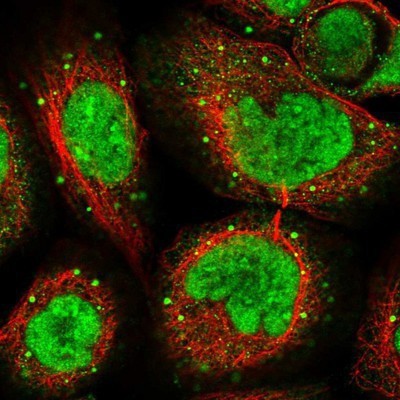 Immunocytochemistry/Immunofluorescence: MTA3 Antibody [NBP1-82919] - Staining of human cell line A-431 shows positivity in nucleus but not nucleoli and vesicles.