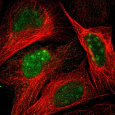 Immunocytochemistry/Immunofluorescence: PHF2 Antibody [NBP1-83080] - Immunofluorescent staining of human cell line U-2 OS shows localization to nucleus & nucleoli.