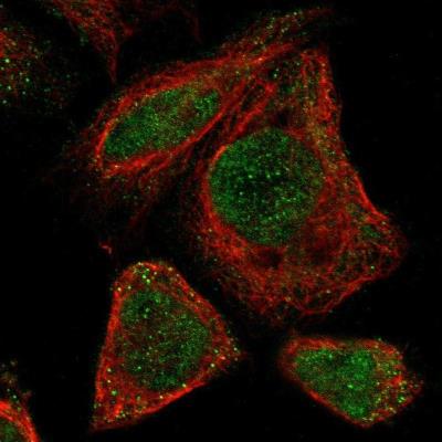 Immunocytochemistry/Immunofluorescence: SLC6A18 Antibody [NBP1-82024] - Staining of human cell line A-431 shows positivity in nucleus and cytoplasm.