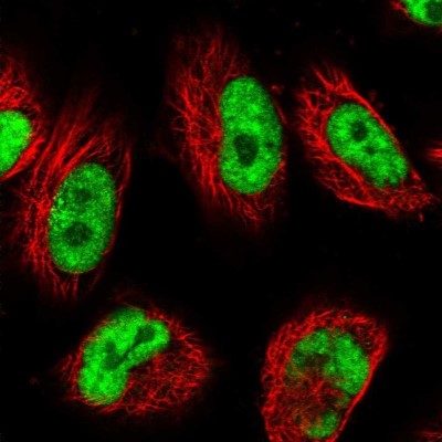 Immunocytochemistry/Immunofluorescence: USP22 Antibody [NBP1-82941] - Staining of human cell line U-251 MG shows localization to nuclear speckles.