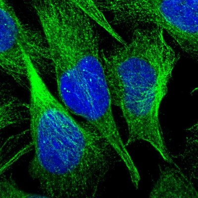 Immunocytochemistry/Immunofluorescence: C9orf16 Antibody [NBP1-83955] - Immunofluorescent staining of human cell line U-2 OS shows localization to microtubules.
