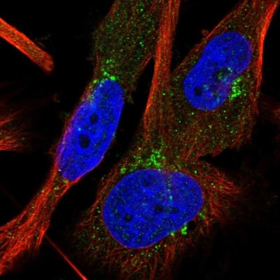Immunocytochemistry/Immunofluorescence: SF3B4 Antibody [NBP1-83191] - Staining of human cell line U-251MG shows positivity in golgi apparatus.