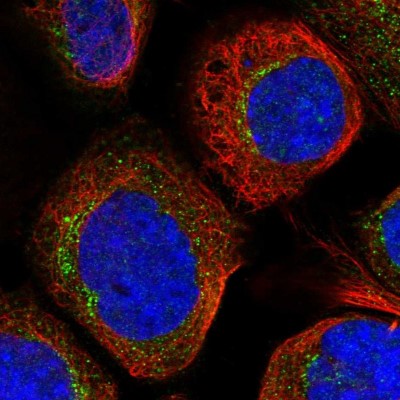 Immunocytochemistry/Immunofluorescence: RPS6KC1 Antibody [NBP1-83141] - Immunofluorescent staining of human cell line A-431 shows localization to vesicles.