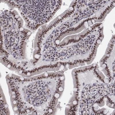 Immunocytochemistry/Immunofluorescence: SETD1A Antibody [NBP1-81513] - Staining of human small intestine shows nuclear positivity in glandular cells.