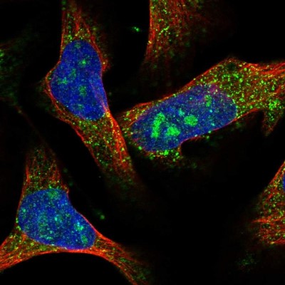 Immunocytochemistry/Immunofluorescence: ACOX1 Antibody [NBP1-80950] - Immunofluorescent staining of human cell line U-2 OS shows localization to nucleoli & vesicles.