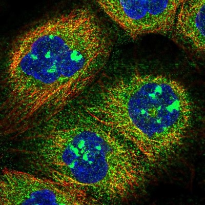 Immunocytochemistry/Immunofluorescence: C20orf117 Antibody [NBP2-13364] - Immunofluorescent staining of human cell line A-431 shows localization to nucleoli & cytosol.