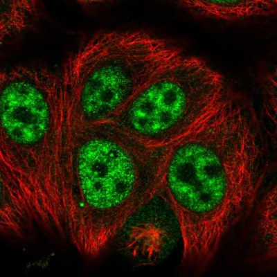 Immunocytochemistry/Immunofluorescence: SRGAP1 Antibody [NBP2-13377] - Immunofluorescent staining of human cell line MCF7 shows localization to nuclear speckles.