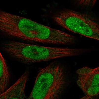 Immunocytochemistry/Immunofluorescence: MLLT1 Antibody [NBP1-84840] - Staining of human cell line U-251 MG shows localization to nucleoplasm & nucleoli fibrillar center.