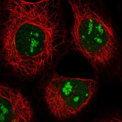 Immunocytochemistry/Immunofluorescence: GPATCH4 Antibody [NBP1-85131] - Immunofluorescent staining of human cell line A-431 shows localization to nucleus & nucleoli.