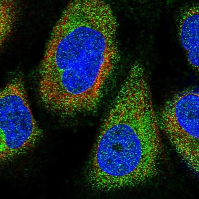 Immunocytochemistry/Immunofluorescence: TRAF7 Antibody [NBP1-85068] - Immunofluorescent staining of human cell line U-2 OS shows localization to plasma membrane & vesicles.