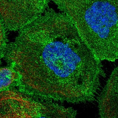 Immunocytochemistry/Immunofluorescence: PMCA4 Antibody [NBP2-31984] - Staining  of human cell line A-431 shows positivity in plasma membrane.