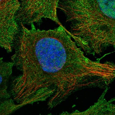 Immunocytochemistry/Immunofluorescence: PHF20L1 Antibody [NBP1-85655] - Immunofluorescent staining of human cell line U-2 OS shows localization to nucleoplasm & plasma membrane.