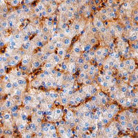 Ninjurin‑1 was detected in immersion fixed paraffin-embedded sections of human liver using Sheep Anti-Human Ninjurin‑1 Antigen Affinity-purified Polyclonal Antibody (Catalog # AF5105) at 3 µg/mL overnight at 4 °C. Before incubation with the primary antibody, tissue was subjected to heat-induced epitope retrieval using Antigen Retrieval Reagent-Basic (Catalog # CTS013). Tissue was stained using the Anti-Sheep HRP-DAB Cell & Tissue Staining Kit (brown; Catalog # CTS019) and counterstained with hematoxylin (blue). Specific staining was localized to endothelial cells in bile canaliculi. View our protocol for Chromogenic IHC Staining of Paraffin-embedded Tissue Sections.