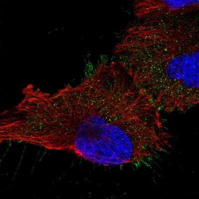 Immunocytochemistry/Immunofluorescence: UBASH3B/STS1/Tula-2 Antibody [NBP2-34053] - Immunofluorescent staining of human cell line U-251 MG shows localization to plasma membrane.