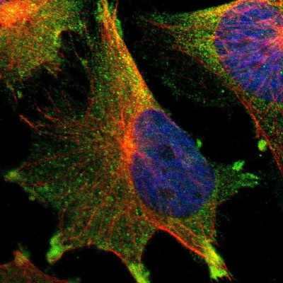 Immunocytochemistry/Immunofluorescence: TTLL12 Antibody [NBP2-33852] - Immunofluorescent staining of human cell line U-251 MG shows localization to plasma membrane & cytosol.
