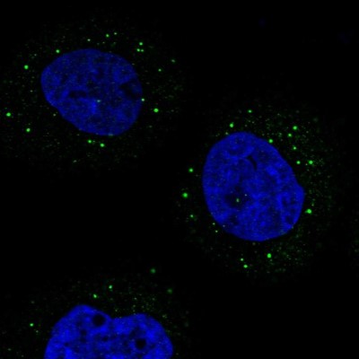 Immunocytochemistry/Immunofluorescence: TRAF3IP3 Antibody [NBP1-86974] - Immunofluorescent staining of human cell line A-431 shows localization to vesicles.