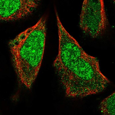 Immunocytochemistry/Immunofluorescence: KIAA1683 Antibody [NBP1-85833] - Staining  of human cell line U-2 OS shows positivity in nucleus but not nucleoli.