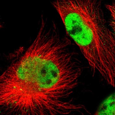 Immunocytochemistry/Immunofluorescence: KIAA0907 Antibody [NBP1-86485] - Immunofluorescent staining of human cell line U-251 MG shows localization to nucleoplasm.