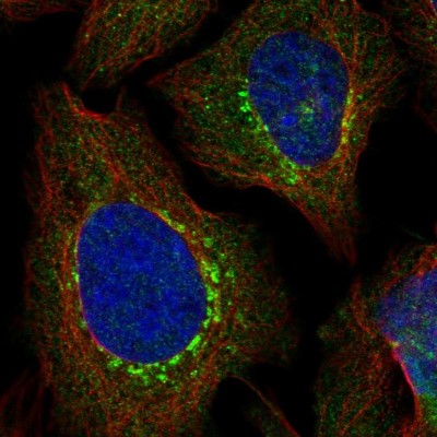 Immunocytochemistry/Immunofluorescence: EVI5 Antibody [NBP1-82596] - Immunofluorescent staining of human cell line U-2 OS shows localization to the Golgi apparatus & vesicles.