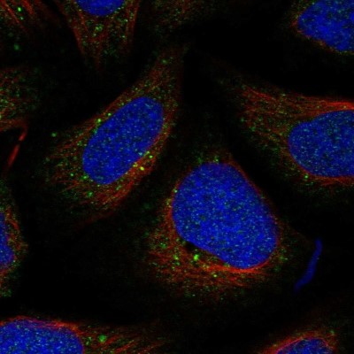 Immunocytochemistry/Immunofluorescence: FYCO1 Antibody [NBP1-83698] - Immunofluorescent staining of human cell line U-2 OS shows localization to vesicles.