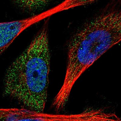 Immunocytochemistry/Immunofluorescence: FGD5 Antibody [NBP1-83877] - Staining of human cell line U-251MG shows positivity in nucleus but not nucleoli and cytoplasm.