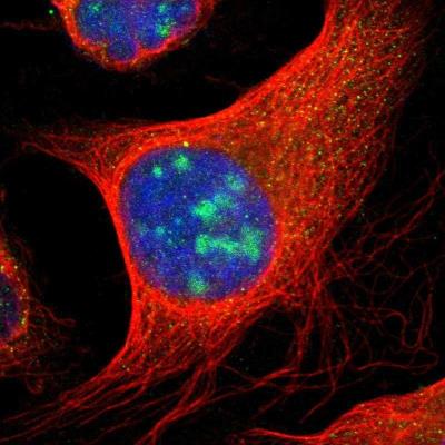 Immunocytochemistry/Immunofluorescence: NPHP3 Antibody [NBP1-83543] - Staining of human cell line U-2 OS shows positivity in nucleoli.
