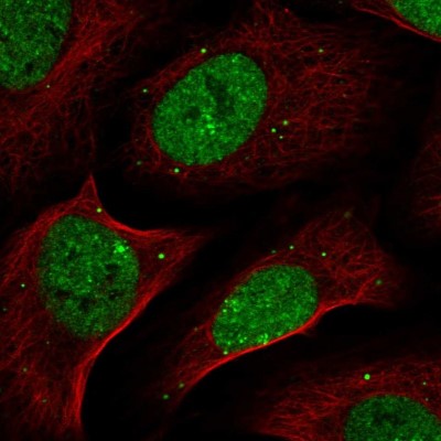 Immunocytochemistry/Immunofluorescence: ZNF638 Antibody [NBP1-82730] - Immunofluorescent staining of human cell line U-2 OS shows localization to nucleoplasm & vesicles.