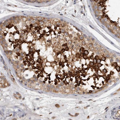 Immunohistochemistry-Paraffin: C7orf43 Antibody [NBP1-83807] - Staining of human testis shows strong cytoplasmic positivity in subset of cells in seminiferus ducts.