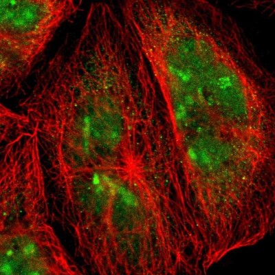 Immunocytochemistry/Immunofluorescence: CoREST3/RCOR3 Antibody [NBP1-83820] - Staining of human cell line A-431 shows positivity in nucleus, nucleoli and cytoplasm.