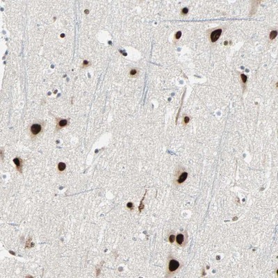 Immunohistochemistry-Paraffin: CoREST3/RCOR3 Antibody [NBP1-83820] - Staining of human cerebral cortex shows strong nuclear positivity in neuronal cells.
