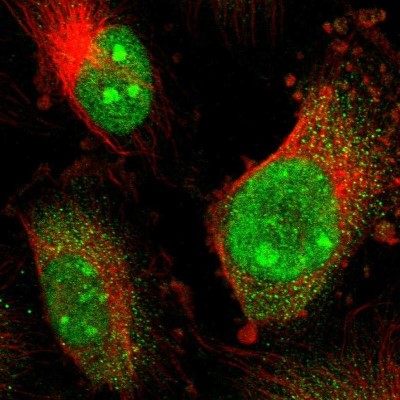 Immunocytochemistry/Immunofluorescence: CoREST3/RCOR3 Antibody [NBP1-83820] - Immunofluorescent staining of human cell line U-251 MG shows localization to nucleus, nucleoli & cytosol.