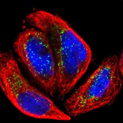 Immunocytochemistry/Immunofluorescence: ACBD5 Antibody [NBP1-85146] - Staining of human cell line A-431 shows localization to peroxisomes.